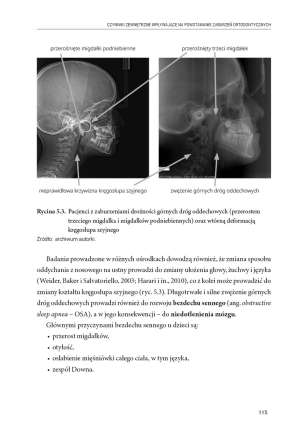 Czynności prymarne w logopedii. Tom 1