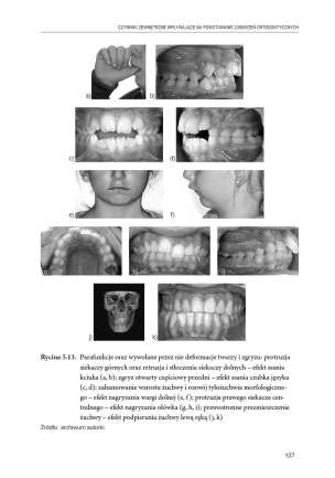 Czynności prymarne w logopedii. Tom 1